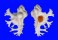 MURICIDAE HOMALOCANTHA ANATOMICA PELE shell