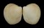 CARDIIDAE FRAGUM ERUGATUM shell