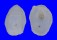HIPPONICIDAE CHEILEA BULLA shell