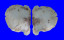 PLACUNIDAE PLACUNA QUADRANGULA shell